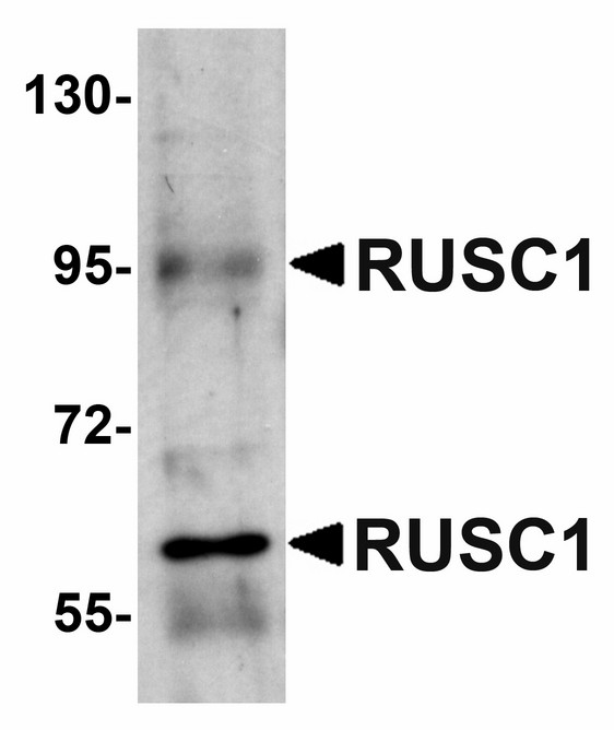 Western blot of RUSC1 in A-20 cell lysate with RUSC1 antibody at 1 ug/ml.
