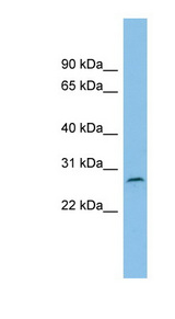 C1orf104 antibody LS-C116583 Western blot of ACHN lysate.