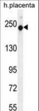 RUSC2 Antibody western blot of human placenta tissue lysates (35 ug/lane). The RUSC2 antibody detected the RUSC2 protein (arrow).