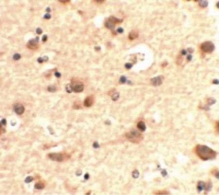 Immunohistochemistry of RUSC2 in human brain tissue with RUSC2 antibody at 5 ug/ml.