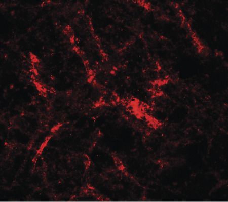 Immunofluorescence of RUSC2 in human brain tissue with RUSC2 antibody at 20 ug/ml.