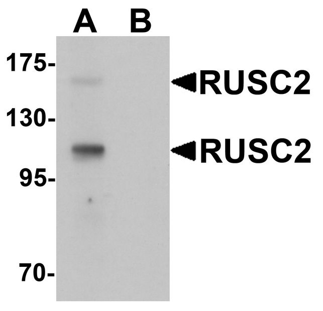 Western blot analysis of RUSC2 in SK-N-SH cell lysate with RUSC2 antibody at 1 ug/ml in (A) the absence and (B) the presence of blocking peptide