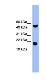 RWDD1 antibody LS-C135512 Western blot of Jurkat lysate.