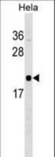 RWDD1 Antibody western blot of HeLa cell line lysates (35 ug/lane). The RWDD1 antibody detected the RWDD1 protein (arrow).