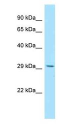 RWDD3 antibody Western Blot of 293T.