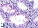 Anti-RXFP1 antibody LS-A566 IHC of human uterus, endometrium. Immunohistochemistry of formalin-fixed, paraffin-embedded tissue after heat-induced antigen retrieval.