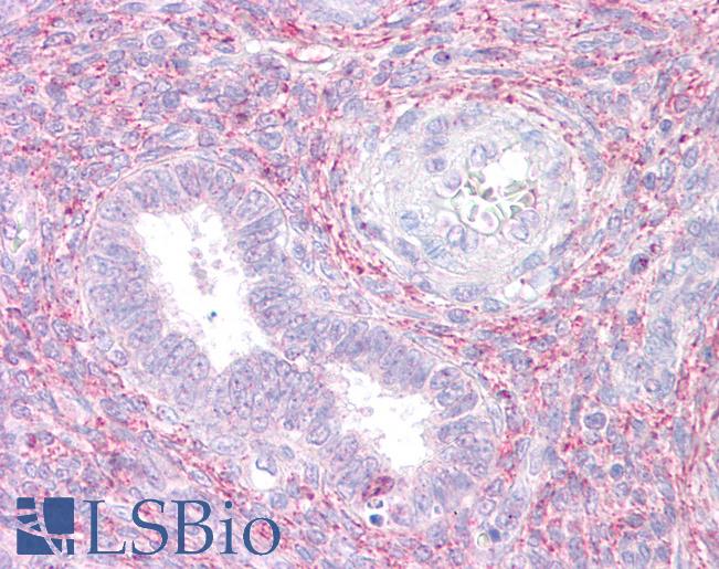 Anti-RXFP1 antibody IHC of human uterus. Immunohistochemistry of formalin-fixed, paraffin-embedded tissue after heat-induced antigen retrieval. Antibody LS-B7212 concentration 10 ug/ml.