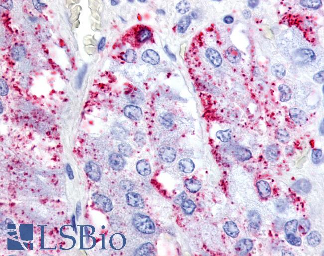 Anti-RXFP1 antibody LS-A565 IHC of human adrenal medulla. Immunohistochemistry of formalin-fixed, paraffin-embedded tissue after heat-induced antigen retrieval.