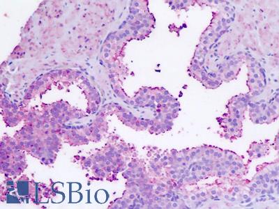 Human Prostate: Formalin-Fixed, Paraffin-Embedded (FFPE)