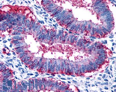 Anti-RXFP2 antibody LS-A4753 IHC of human uterus. Immunohistochemistry of formalin-fixed, paraffin-embedded tissue after heat-induced antigen retrieval.