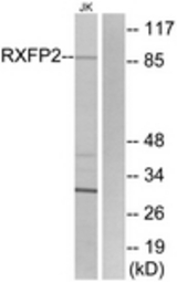Western blot of extracts from Jurkat cells, using RXFP2 Antibody. The lane on the right is treated with the synthesized peptide.