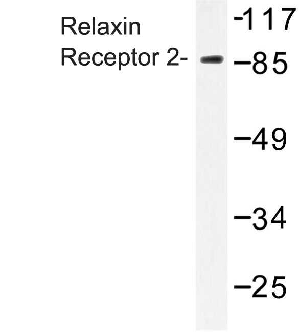 Western blot of Relaxin Receptor 2 (L152) pAb in extracts from Jurkat cells.