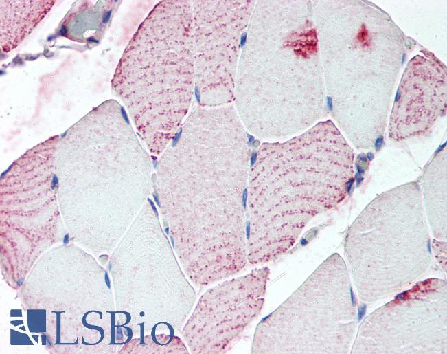 Anti-RXFP2 antibody LS-A4752 IHC of human skeletal muscle. Immunohistochemistry of formalin-fixed, paraffin-embedded tissue after heat-induced antigen retrieval.