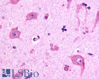 Anti-RXFP3 antibody LS-A1745 IHC of human brain, neurons and glia. Immunohistochemistry of formalin-fixed, paraffin-embedded tissue after heat-induced antigen retrieval.