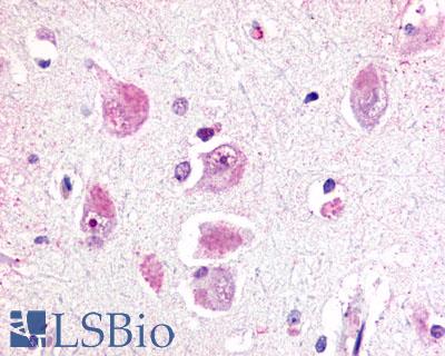 Anti-RXFP3 antibody LS-A1742 IHC of human brain, neurons and glia. Immunohistochemistry of formalin-fixed, paraffin-embedded tissue after heat-induced antigen retrieval.