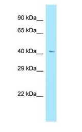 RXFP4 / GPR100 antibody Western Blot of Fetal Lung.