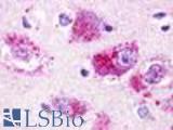 Anti-RXFP4 antibody LS-A553 IHC of human brain, neurons and glia. Immunohistochemistry of formalin-fixed, paraffin-embedded tissue after heat-induced antigen retrieval.