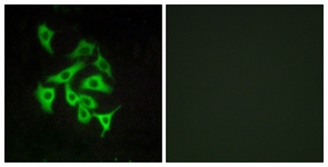 Immunofluorescence of A549 cells, using GPR100 Antibody. The picture on the right is treated with the synthesized peptide.