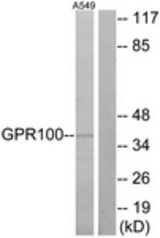 Western blot of extracts from A549 cells, using GPR100 Antibody. The lane on the right is treated with the synthesized peptide.