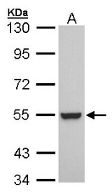 Sample (30 ug of whole cell lysate). A: A431. 7.5% SDS PAGE. RXRB antibody diluted at 1:1000.
