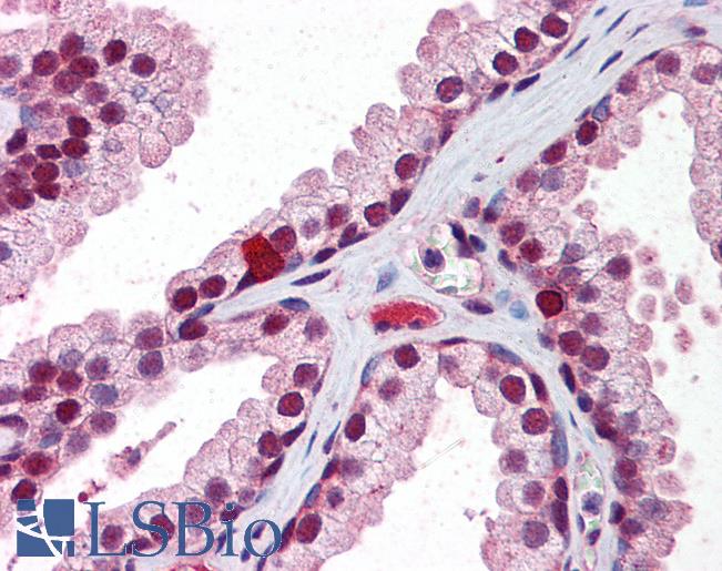 Anti-RXRB antibody IHC of human prostate. Immunohistochemistry of formalin-fixed, paraffin-embedded tissue after heat-induced antigen retrieval. Antibody LS-B5882 concentration 2.5 ug/ml.