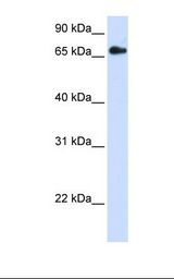 Transfected 293T cell lysate. Antibody concentration: 1.0 ug/ml. Gel concentration: 12%.
