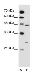 A: Marker, HepG2 Cell Lysate