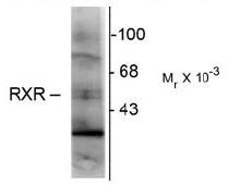 Western blot of hippocampal lysate showing immunolabeling of the ~48k RXR-gamma isotype.