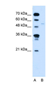 RXRG antibody LS-C40311 Western blot of Jurkat lysate.