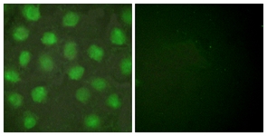 Immunofluorescence of HUVEC cells, using Retinoid X Receptor gamma Antibody. The picture on the right is treated with the synthesized peptide.