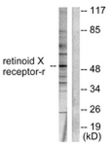 Western blot of extracts from HepG2 cells, using Retinoid X Receptor gamma Antibody. The lane on the right is treated with the synthesized peptide.