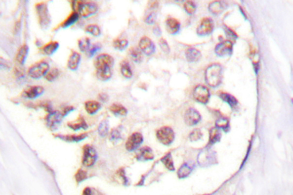 IHC of Retinoid X Receptor (L200) pAb in paraffin-embedded human lymph node breast carcinoma tonsil tissue.
