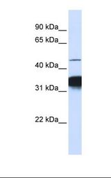 Jurkat cell lysate. Antibody concentration: 1.0 ug/ml. Gel concentration: 12%.