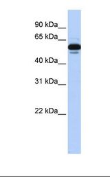 Transfected 293T cell lysate. Antibody concentration: 1.0 ug/ml. Gel concentration: 12%.
