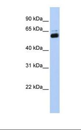 Transfected 293T cell lysate. Antibody concentration: 1.0 ug/ml. Gel concentration: 12%.