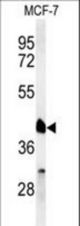 Western blot of RXRA Antibody in MCF-7 cell line lysates (35 ug/lane). RXRA (arrow) was detected using the purified antibody.