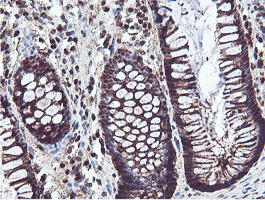 IHC of paraffin-embedded Human colon tissue using anti-PSMB7 mouse monoclonal antibody.