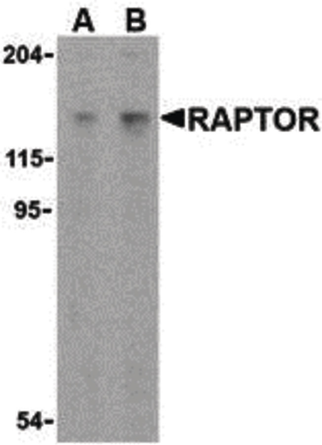 Western blot of Raptor in L1210 cell lysate with Raptor antibody at (A) 2 and (B) 4 ug/ml.