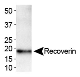 Recoverin Antibody (6A55CD6) -Western blot of Recoverin expression in human brain.