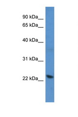 RCVRN / Recoverin antibody LS-C134980 Western blot of Jurkat Cell lysate. Antibody concentration 1 ug/ml.