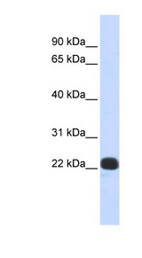 RCVRN / Recoverin antibody LS-C101482 Western blot of Placenta lysate.