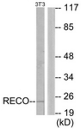 Western blot of extracts from NIH-3T3 cells, using Recoverin Antibody. The lane on the right is treated with the synthesized peptide.