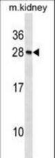 Mouse Rcvrn Antibody western blot of mouse kidney tissue lysates (35 ug/lane). The Rcvrn antibody detected the Rcvrn protein (arrow).