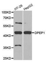 Western blot analysis of extracts of various cell lines, using DPEP1 antibody.