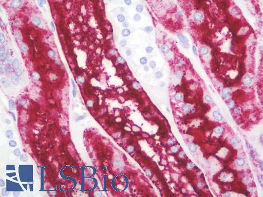 Anti-Renal Dipeptidase / DPEP1 antibody IHC staining of human kidney. Immunohistochemistry of formalin-fixed, paraffin-embedded tissue after heat-induced antigen retrieval. Antibody LS-B9622 dilution 1:100.