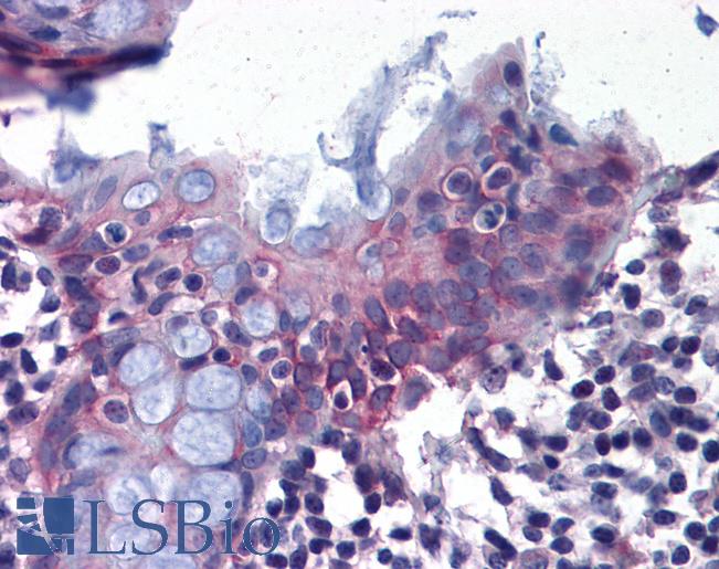 Anti-DPEP1 antibody LS-A8268 IHC of human colon. Immunohistochemistry of formalin-fixed, paraffin-embedded tissue after heat-induced antigen retrieval.