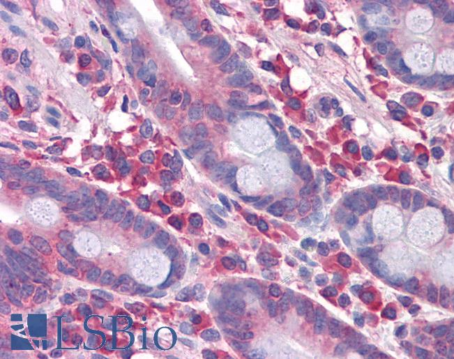 Anti-DPF2 antibody IHC of human small intestine. Immunohistochemistry of formalin-fixed, paraffin-embedded tissue after heat-induced antigen retrieval. Antibody LS-B4402 concentration 2.5 ug/ml.