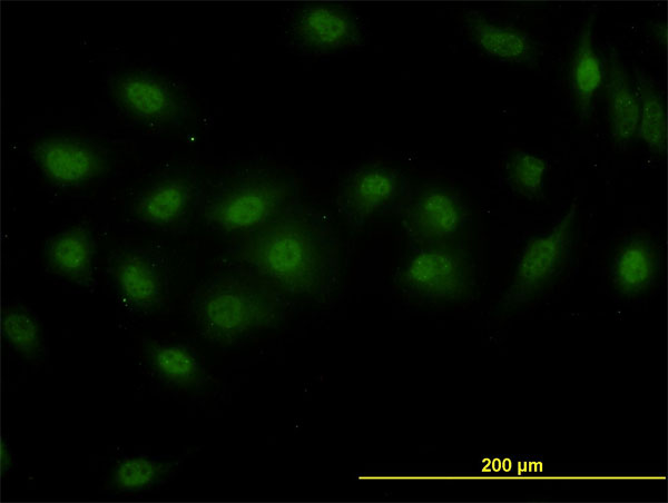 Immunofluorescence of monoclonal antibody to DPF2 on HeLa cell (antibody concentration 10 ug/ml).