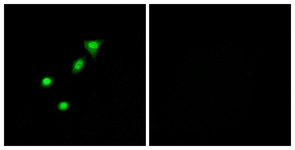 Immunofluorescence of A549 cells, using REQU Antibody. The picture on the right is treated with the synthesized peptide.