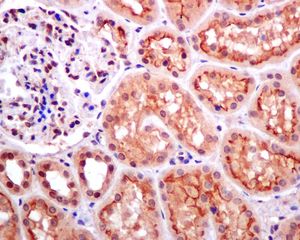 IHC of paraffin-embedded human kidney tissue using anti-DPF2 antibody.